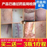 韩国祛疤膏去疤痕灵正品除疤痕凹凸疤修复祛疤膏手术伤疤疙瘩产品