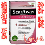 现货 美国进口Scaraway剖腹产硅胶疤痕贴 修复烫伤去祛疤遮疤增生