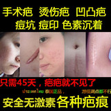泰国疤痕修复膏40g祛去凹凸手术伤疤刀疤剖腹产烫烧伤疤痘印儿童