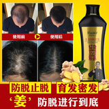 生姜洗发水防脂溢性脱发防脱增发密发男女士无硅油正品头发增长液