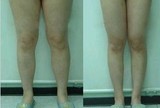 量身定制瘦腿精油强效减腿瘦腿减脂肪减肌肉产品 有效瘦大腿小腿