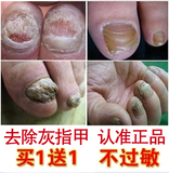治灰指甲特效专用药亮甲手脚指甲去除灰指甲根疗软甲膏修复液