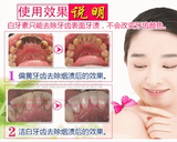 美白水速效去黄牙烟牙茶渍牙垢牙菌斑洗牙液牙贴神器白牙素牙齿