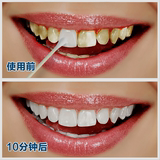 速效美白牙齿洗牙液洁牙粉强效去烟牙黄牙黑牙齿贝白白牙素