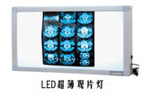 特价正品医用LED观片灯、单联、双联、三联LED观片灯箱、智能调光