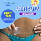 百德丝疤痕贴 美国Biodermis 手术疤 增生疤  剖腹产疤痕硅胶贴