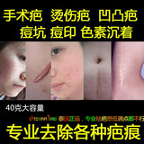 泰国正品40g大包装祛疤去疤痕修复膏灵除疤手术妊娠纹剖腹产烫伤