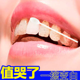 牙齿美白速效去除黄牙烟渍牙垢快速白牙素洗牙液牙粉牙贴牙膏神器