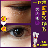 脂肪粒特效眼霜去除眼部细纹紧致保湿眼袋黑眼圈油脂粒补水保湿
