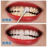 豫冠2016牙斑净白白牙素漂白洁白10mL通用常规单品牙齿美白脱色剂