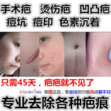 泰国去疤痕灵祛疤膏产品去疤痕凹凸疤修复膏去手术伤疤祛烧伤痘坑