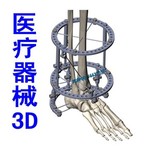 医疗器械外固定支架牵伸器履带攀爬轮椅牙科椅模型3D设计模型图纸