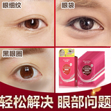 黑眼圈眼膜贴10对特效去眼袋黑眼圈祛细纹补水紧致护眼贴男女正品