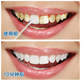 冲冠特价牙斑净白白牙素速效漂白10mL通用常规单品牙齿美白脱色剂