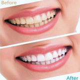 刷牙粉速效去除烟渍黑牙黄牙牙渍牙结石牙垢牙白粉美白牙齿洗牙粉