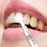 牙齿美白速效提亮牙笔去黄牙烟渍茶渍牙渍口腔清洁牙垢牙结石口臭