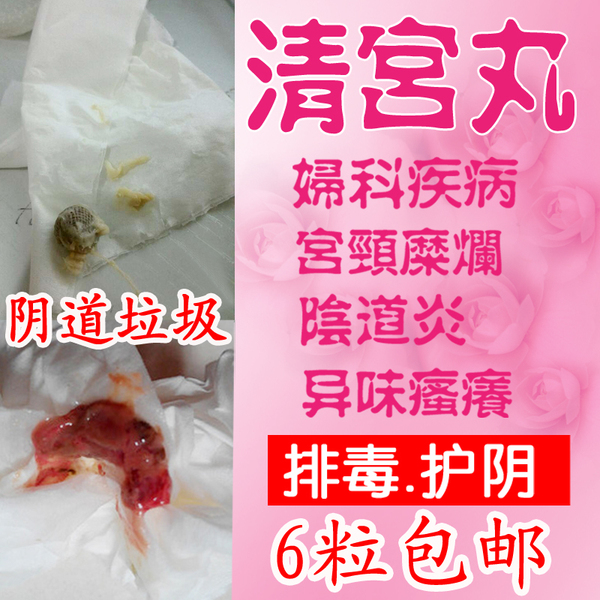 正品清宫丸宫颈糜烂重度妇科炎症用药霉菌性阴道炎异味瘙痒纯中药