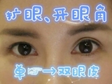 扩眼精油男女士扩眼单眼皮变双增大眼睛永久双眼皮神器