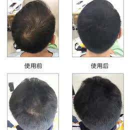 ヘアケア ウィッグ ふわふわスプレー 淘宝網エージェント 日本の淘宝網 Janpantobuy Com