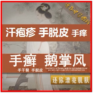 鹅掌风 手癣 手脱皮修复霜 汗疱疹油 水泡干裂掌灵膏 手气痒特效